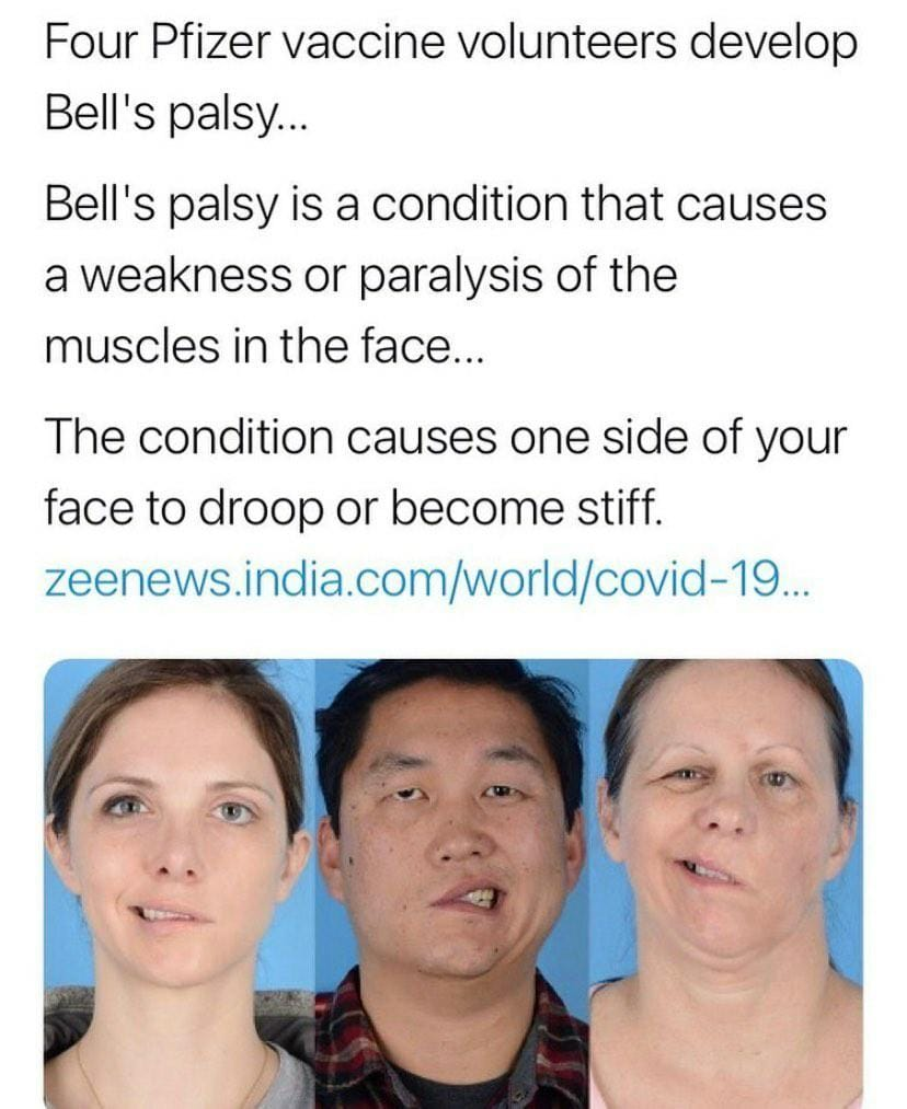 The original tweet that revealed four volunteers who participated in the COVID-19 vaccine developed Bell's palsy.